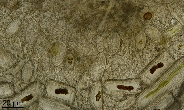 Centropyxis discoides