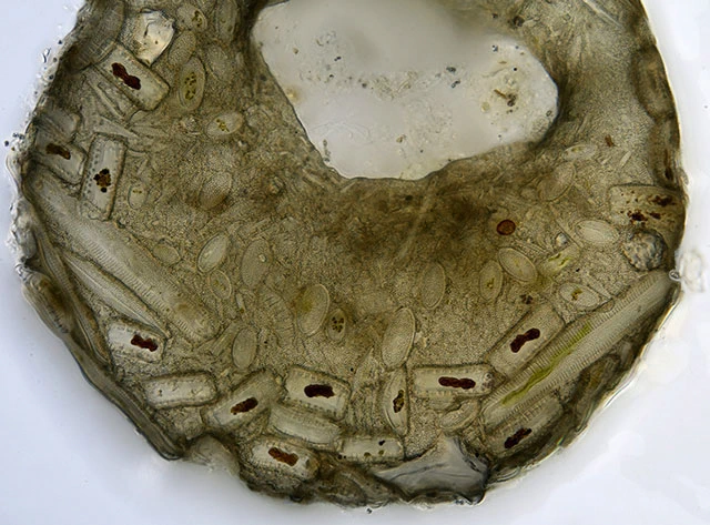 Centropyxis discoides