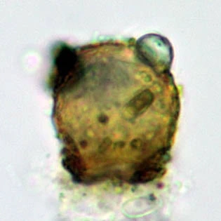 Cryptodifflugia spec.