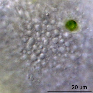 Difflugia capreolata