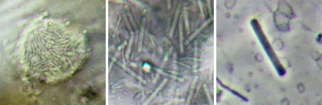 Bacteria - endosymbionts