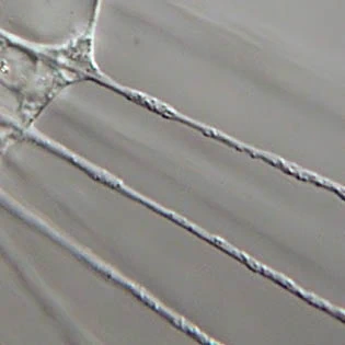 Axopodia