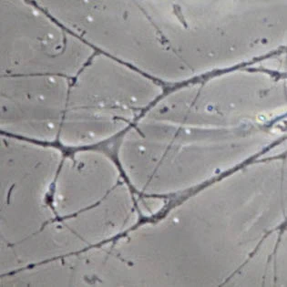 Granuloreticulum
