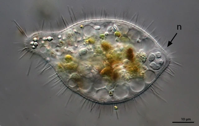 Mastigamoeba setosa