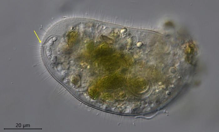 Mastigamoeba setosa