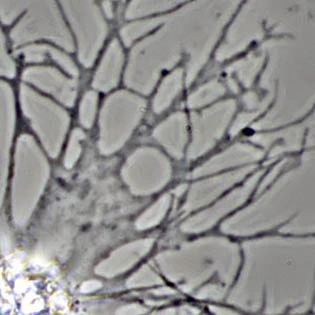 Reticulopodium