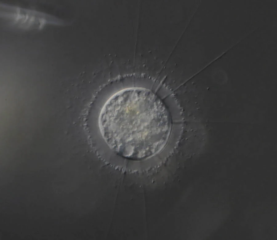 Nuclearia delicatula