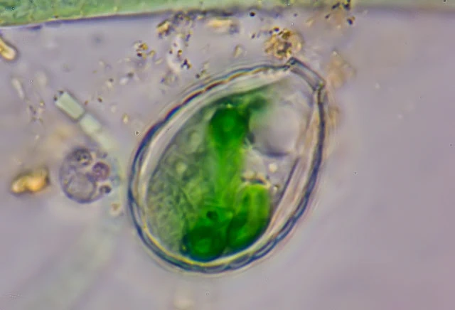 Paulinella chromatophora