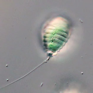 Paulinella chromatophora