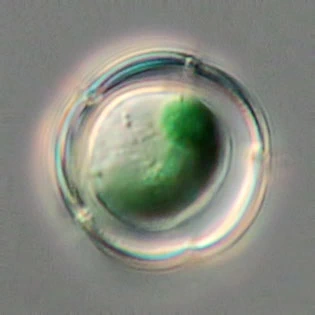 Paulinella chromatophora