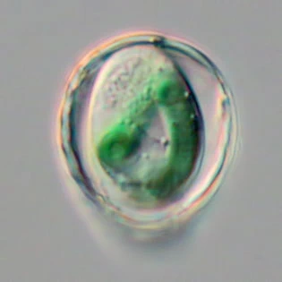 Paulinella chromatophora