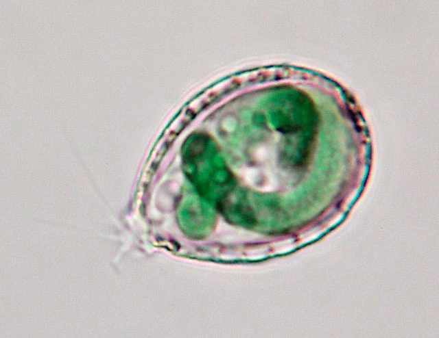 Paulinella chromatophora