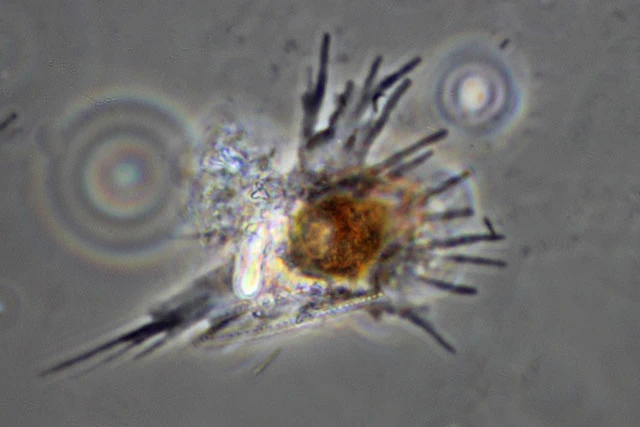 Phryganella paradoxa