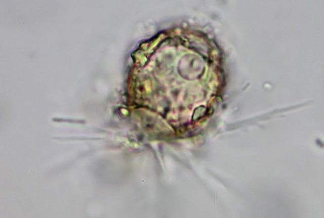Phryganella paradoxa