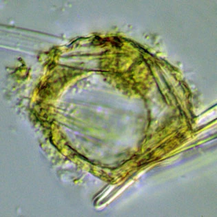 Phryganella acropodia