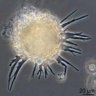 Phryganella acropodia