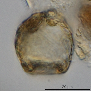 Cryptodifflugia paradoxa