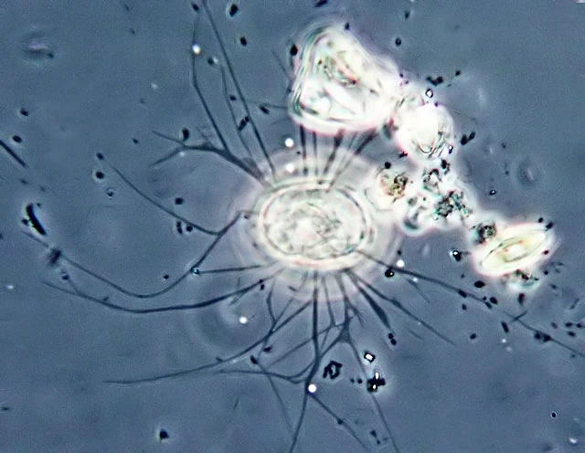 Plagiophrys scutiformis