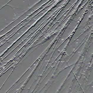 Granuloreticulum