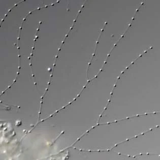 Granulopodia