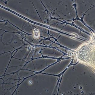 Reticulopodium