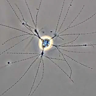 Granulopodia