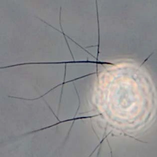 Filopodia