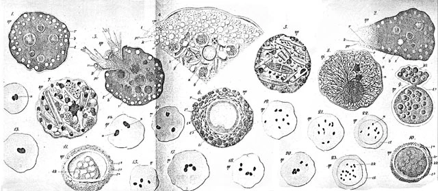 Zonomyxa violacea